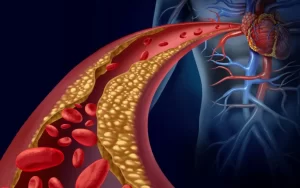 colesterol_4fBZwpDPcS-1024×640