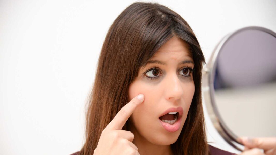 Freedom-from-dark-circles