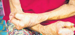 1746706289_kusta-1200×560