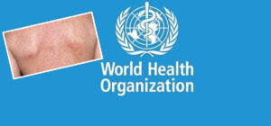 1755574142_rubela-1200×560