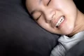 OIP